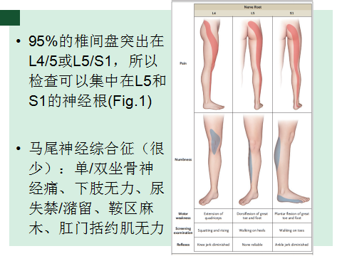 腰突最新疗法引领康复新时代